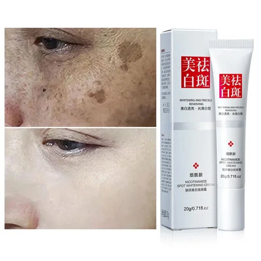 Whitening Freckle Cream Trendy Tags